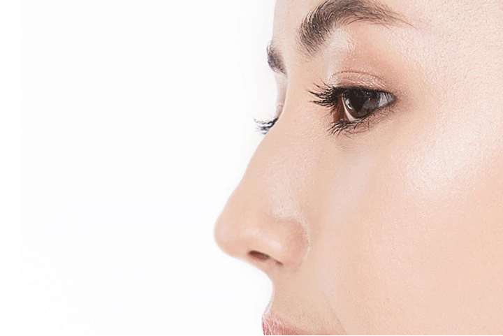 韓国の素晴らしい整形外科病院の軽度のこぶ鼻手術方法ステップ1