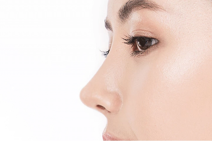 韓国の素晴らしい整形外科病院の軽度のこぶ鼻手術方法ステップ3