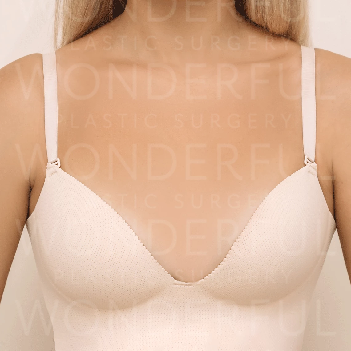 wonderful-plastic-surgery-hospital-korea-breast-augmentation-before-after-results-before-2