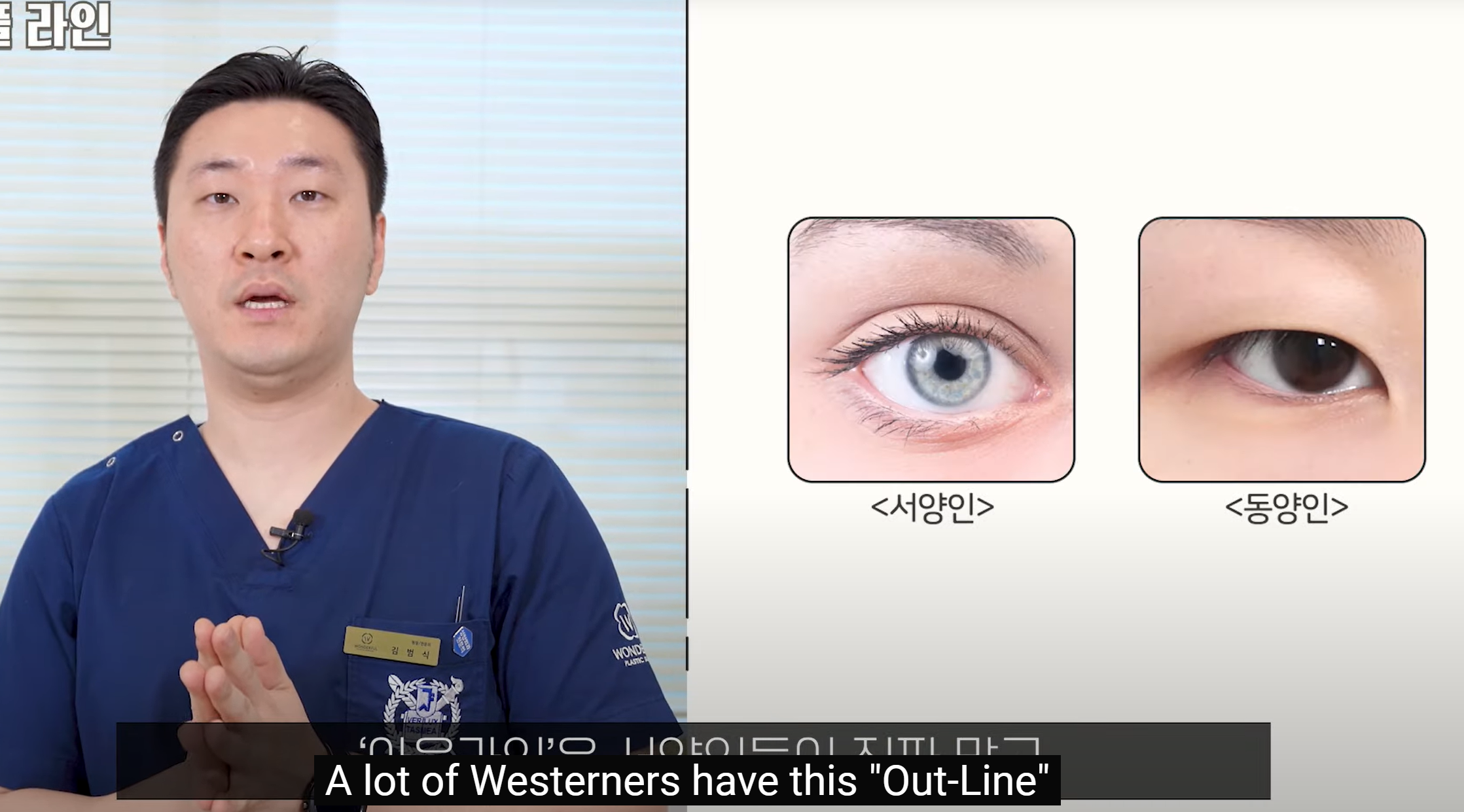 韩国精彩整形外科首尔双眼皮手术