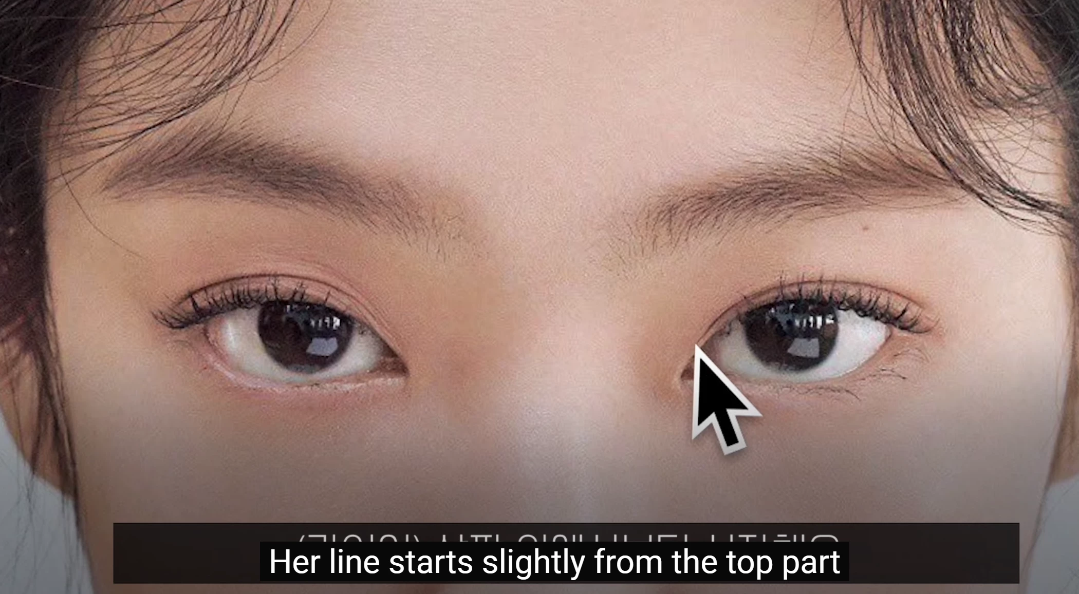 มหัศจรรย์ศัลยกรรมพลาสติกในเกาหลีศัลยกรรมตาสองชั้นโซล